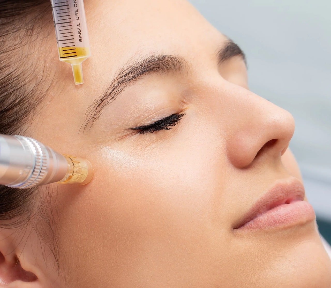 A fine needling pen held at a woman's cheek during a skin treatment